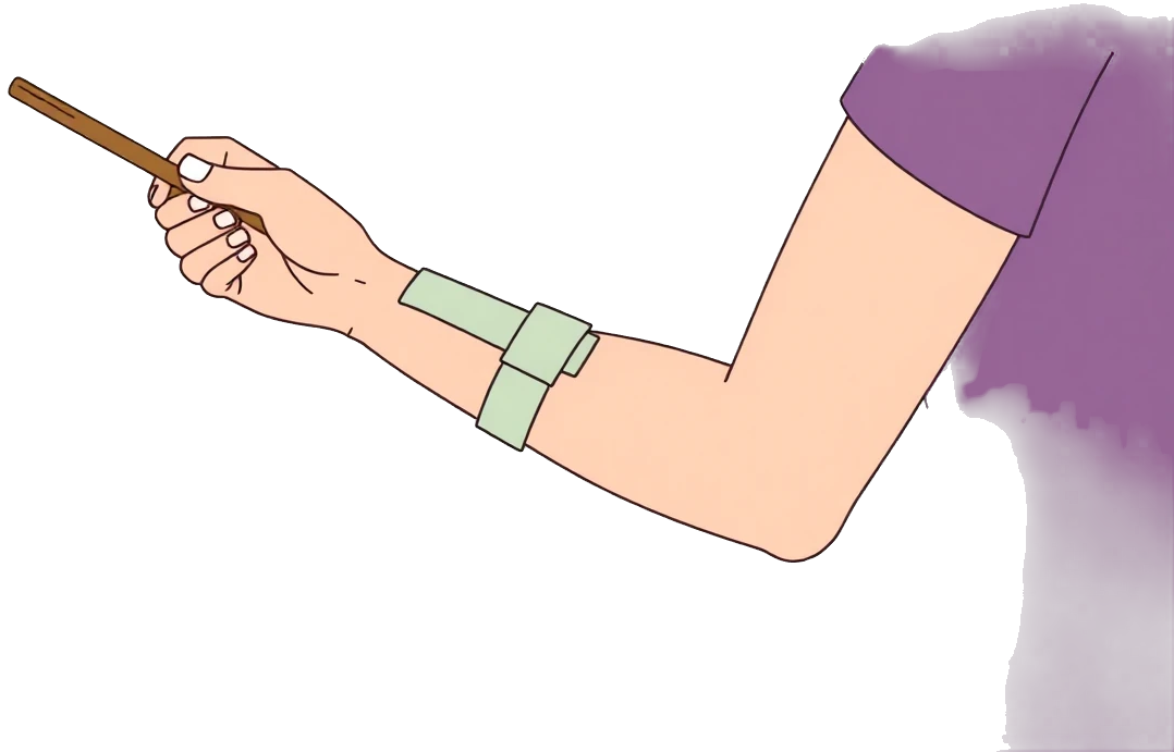 Ilustração de imobilização de fratura